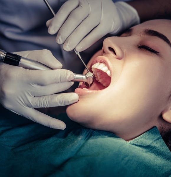 Root Canal Treatment