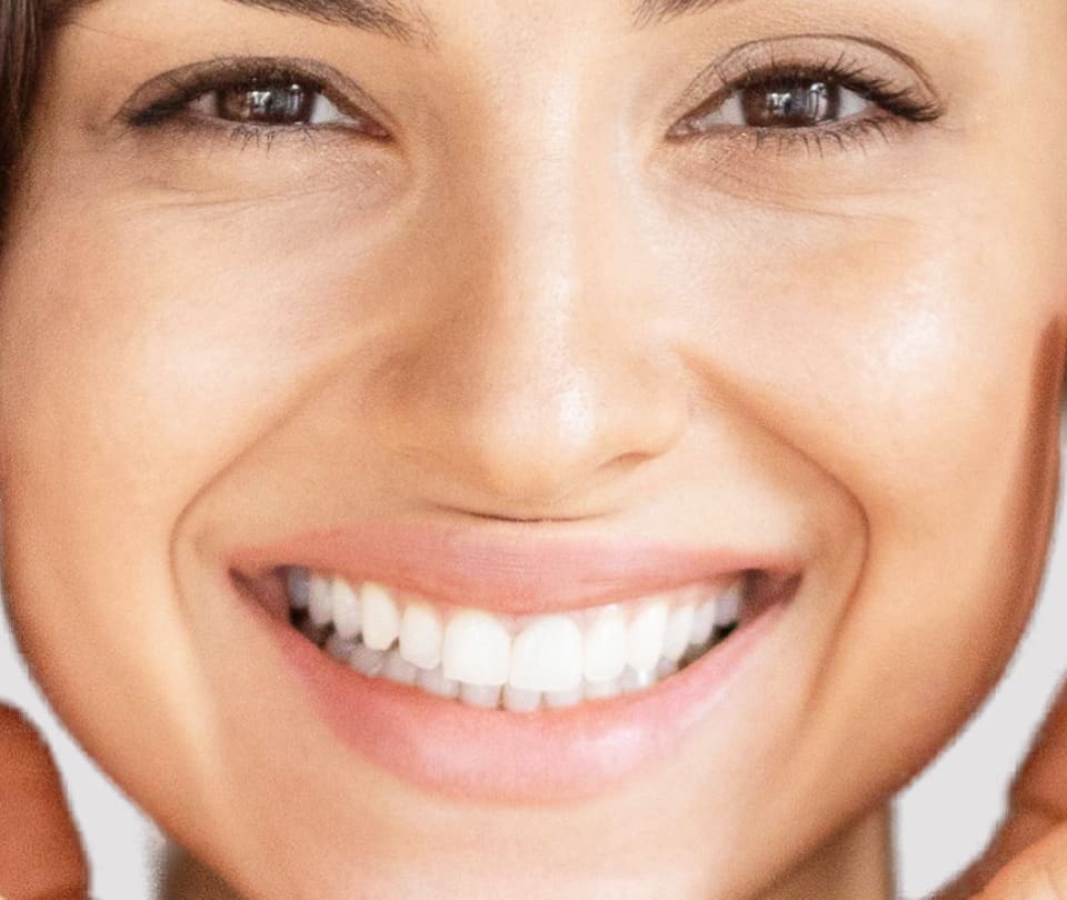 Dermal Fillers
