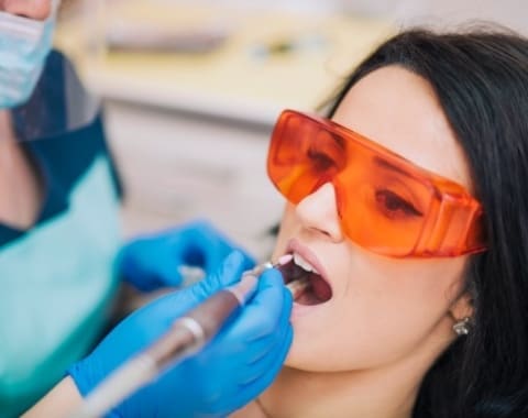 Tooth Stain Removal
