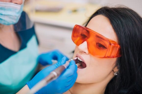 Tooth Stain Removal