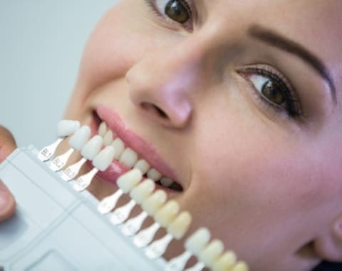 Composite Edge Bonding