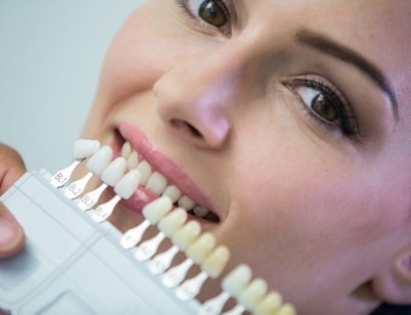 Composite Edge Bonding