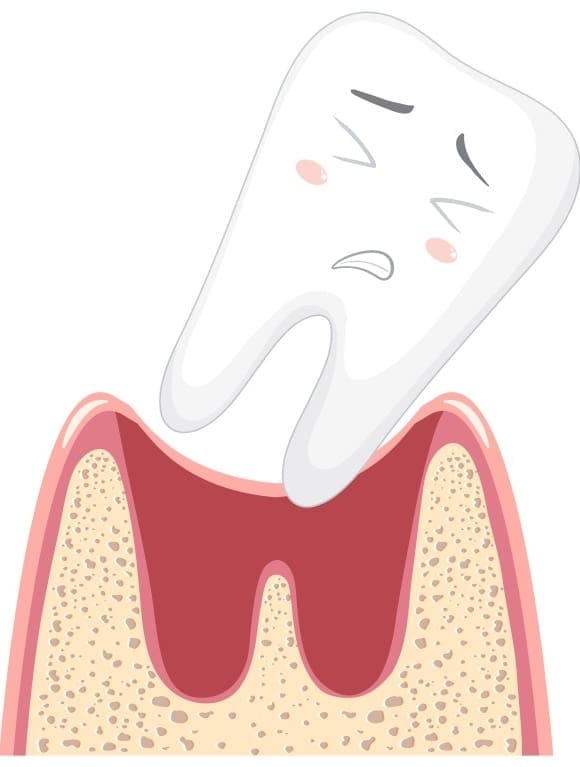 Wisdom Tooth Wobbly
