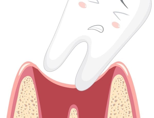Wisdom Tooth Wobbly